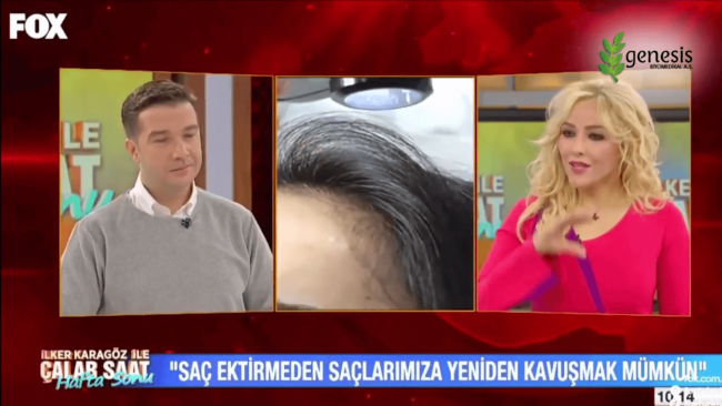 fox-tv-regenera-activa-otolog-mikrogreft